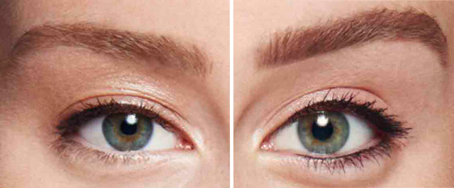 Antes y Después